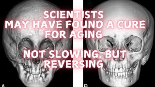 Scientists may have found a cure for aging [upl. by Martell603]