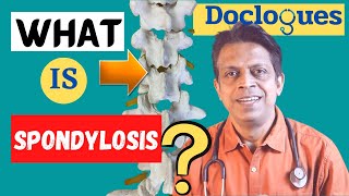 What is Spondylosis [upl. by Learrsi]