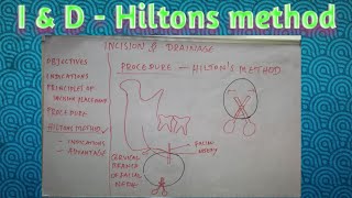 Incision and drainage  hiltons method of abscess drainage [upl. by Ahsitahs]