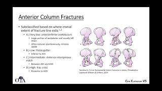 Radiographic evaluation of acetabulum fractures 2 classification and elementary types  OTA CCv5 [upl. by Ilona]