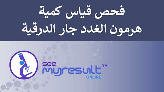 Parathyroid Hormone PTH Test فحص قياس كمية هرمون الغدد جار الدرقية PTH [upl. by Saied755]