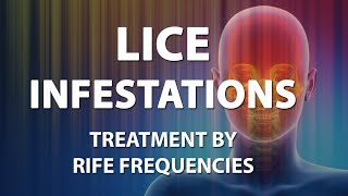 Lice Infestations Head  RIFE Frequencies Treatment  Energy amp Quantum Medicine with Bioresonance [upl. by Berl]