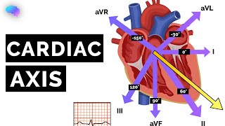 Cardiac Axis Explained  ECG  EKG  OSCE Guide  UKMLA  CPSA [upl. by Leahcimluap839]