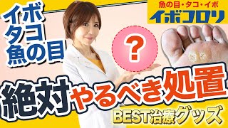 【イボ・タコ・魚の目】今スグ実践！最短治療のコツは削ること！皮膚科医がイボコロリを使って実演します [upl. by Nonnahsed]