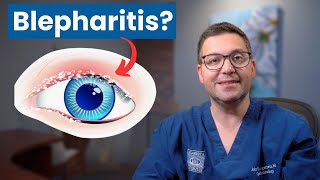 Easy Home Remedies for Blepharitis amp MGD Relief [upl. by Nnanerak544]