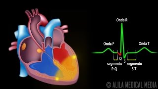 El Sistema de Conducción Cardíaca y la Relación con ECG Animación Alila Medical Media Español [upl. by Nekial]