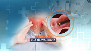 Cảnh giác với ung thư vòm họng  VTC14 [upl. by Kcirtapnhoj]