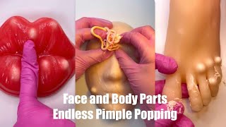 Endless Pimple Popping Satisfying ASMR on Squishy Face and Body [upl. by Nwadal773]