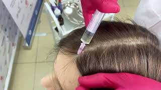 Применение Apriline Meso Hair Line [upl. by Kerr]