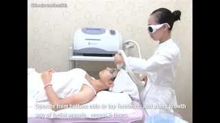 IPL  PTF Laser Hair Removal amp Skin Treatment Machine [upl. by Kylen]