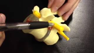 Sciatica Treatment using the Reverse Hyper  Susquehanna Spine Lancaster  WestsideMedical [upl. by Liamsi]