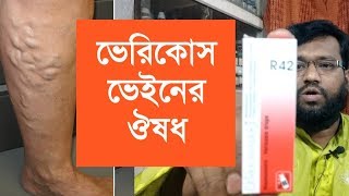 ভেরিকোস ভেইন শিরা স্ফীতির হোমিওপ্যাথি ঔষধ।varicose veins homeopathy medicine [upl. by Adner]