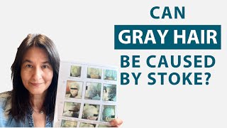 Can Gray Hair be Caused by a Hemorrhagic Stroke — Proof of Gray Hair Reversal with Cerebrolysin [upl. by Aral]