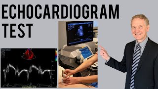 Echocardiogram Procedure  Heart Ultrasound  Everything you need to know [upl. by Koloski]