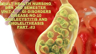 AdulHealthNursing BSN3rd semester Unitl GIDisorders Disease No10 Cholecystitis and cholelithiasis [upl. by Elleynod]