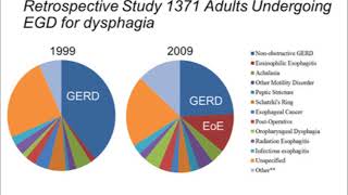 Eosinophilic Esophagitis 2015 From Acid Reflux to Food Allergy [upl. by Ahsiruam]