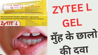 How to Use Zytee Gel for Mouth Ulcer Relief  Zytee L Benefits Uses in Hindi [upl. by Luar638]