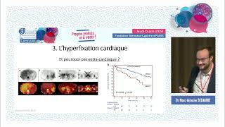 La scintigraphie osseuse dans l’amylose à transthyrétine  intérêt et limites [upl. by Inalan431]