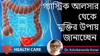 Peptic Ulcer Symptoms  কোন লক্ষণ গুলি হলে বুঝবেন গ্যাস্ট্রিক আলসার হয়েছে  Dr Ashokananda Konar [upl. by Aneer]