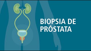 Biopsia de Prostata Lo Que Usted Debe Saber  Urology Care Foundation [upl. by Bounds]