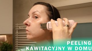 PEELING KAWITACYJNY W DOMU  CENA ZALETY EFEKTY [upl. by Gnoix]