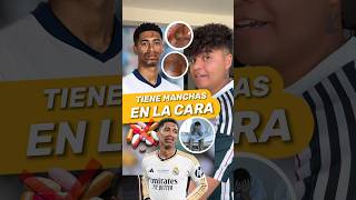 😱 ¿Que le ha pasado a Jude Bellingham Mira el video y entérate‼️ futbol shorts football soccer [upl. by Irpak280]