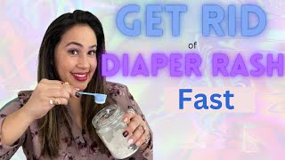 5 Home Remedies for Diaper Rash That Really Work Natural Diaper Rash Remedies [upl. by Ecyrb710]