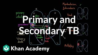 Primary and Secondary TB  Infectious diseases  NCLEXRN  Khan Academy [upl. by Ymorej]