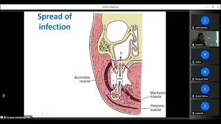 Oral amp Maxillofacial Surgery Part 5 FASCIAL SPACE INFECTION Volume 1 dentist bds medical [upl. by Sibyls]