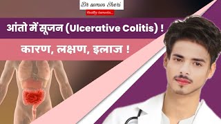 आंतो में सूजन का इलाज Ulcerative Colitis ka ilaj Ulcerative Colitis Treatment [upl. by Ltihcox967]