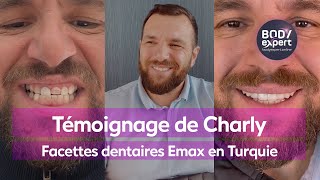 DENTISTE EN TURQUIE  🦷 Témoignage Charlie  10 Facettes Emax  gummy smile  BODYEXPERT [upl. by Anatnom]