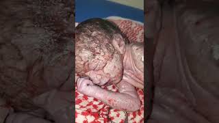 Newborn baby clean the body lot of vernix and caseoese newborn baby [upl. by Innattirb]