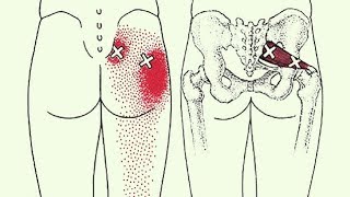 6 Sciatica Stretches To Prevent And Relieve Hip And Lower Back Pain [upl. by Llemaj]