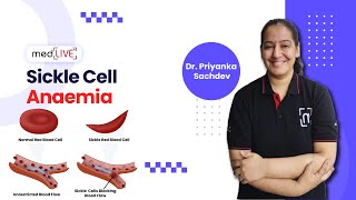 Sickle Cell Anaemia  Pathogenesis  Factors  Diagnosis by DR Priyanka Sachdev  MedLive [upl. by Glick310]