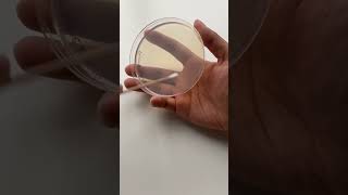 Bacterias on yours mobile screen latest trending shortvideo viralvideo shorts song phone [upl. by Call259]