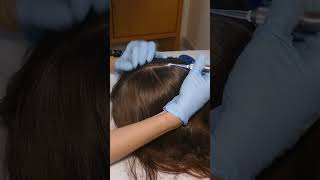 ASMR Scalp Check amp Hairline Exam with Sensory Tests Real Person asmr shorts short [upl. by Ydniahs]