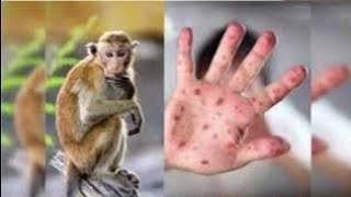 Ways How To Avoid Monkey pox Disease [upl. by Ainorev]