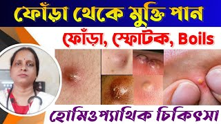 Fora Treatment Bangla  ফোঁড়া চিকিৎসা  Best Medicine For Boils  Homeopathy Medicine For Fora [upl. by Strickman]