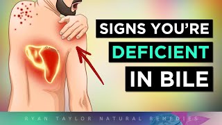 12 Strange Signs of a BILE Deficiency [upl. by Minerva]