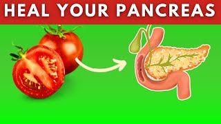 20 Best Foods For Pancreatitis Heal Pancreas Naturally [upl. by Llerral384]