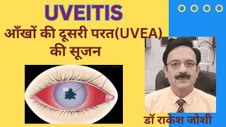 Uveitis  Causes Symptoms amp Treatment [upl. by Ennoira]