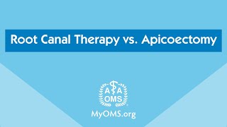 Root Canal Therapy vs Apicoectomy [upl. by Irrej]