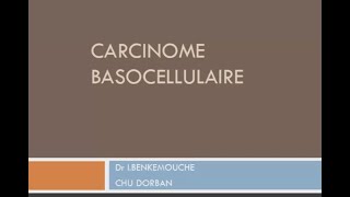 CARCINOME BASOCELLULAIRE  Dr BENKEMOUCHE [upl. by Ray]