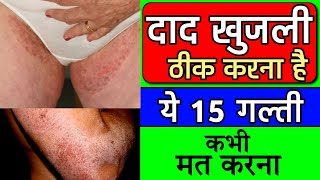 fungal infection in private parts  fungal infection treatment  fungal infection on skin [upl. by Trudie]