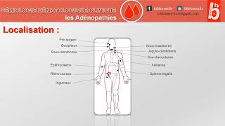 Sémiologie Hématologique les Adénopathies [upl. by Ylim]