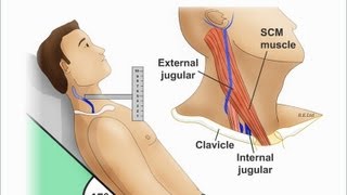 Jugular Venous Distention Explained clearly PART A Jugular venous pressure Waveform [upl. by Rabjohn]