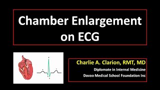 Chamber Enlargement on ECG [upl. by Ariadne]