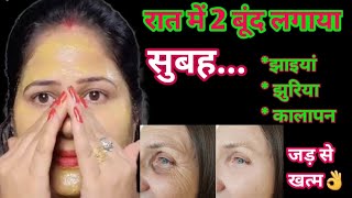 कितनी भी पुरानी झाइयांPigmentation जड़ से खत्म करें 100 इलाज  How to remove pimutation [upl. by Mapes]