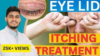 Eye Itching Causes Treatment Home remedies  Itching under Eye Skin [upl. by Rhyner498]