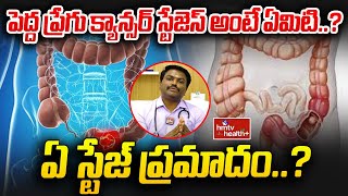 పెద్ద ప్రేగు క్యాన్సర్ స్టేజెస్ అంటే ఏమిటి ఏ స్టేజ్ ప్రమాదం  Rectal Cancer Symptoms [upl. by Manouch]